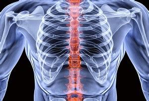 лечение на остеохондроза на гръбначния стълб Уикипедия